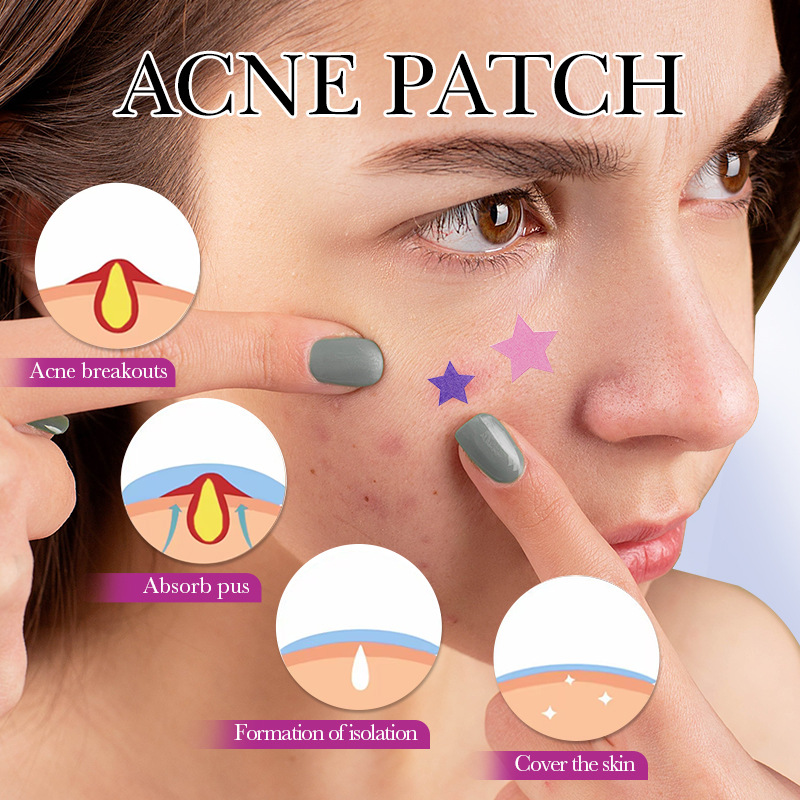 Parche colorido para acné de e - Skincare Qv reseña y precio