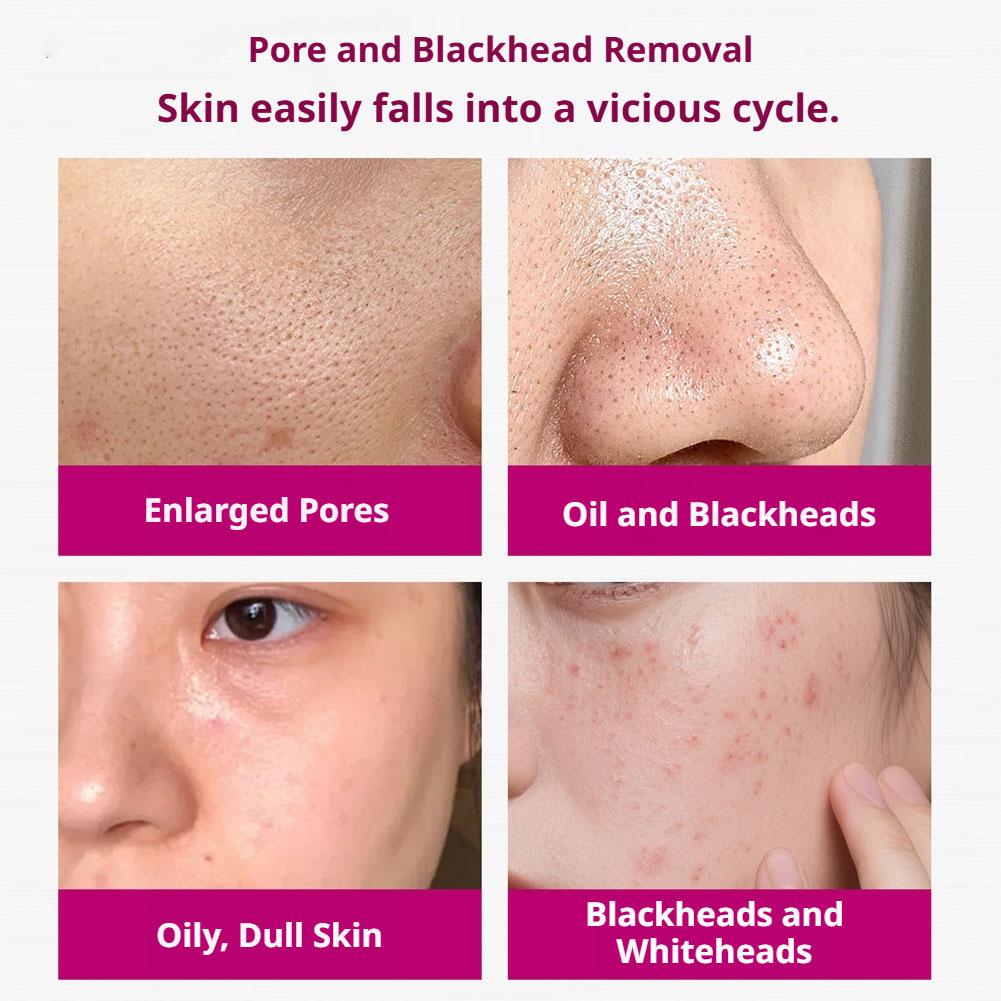 Suero con Ácido Salicílico par - Skincare Skintific reseña y precio