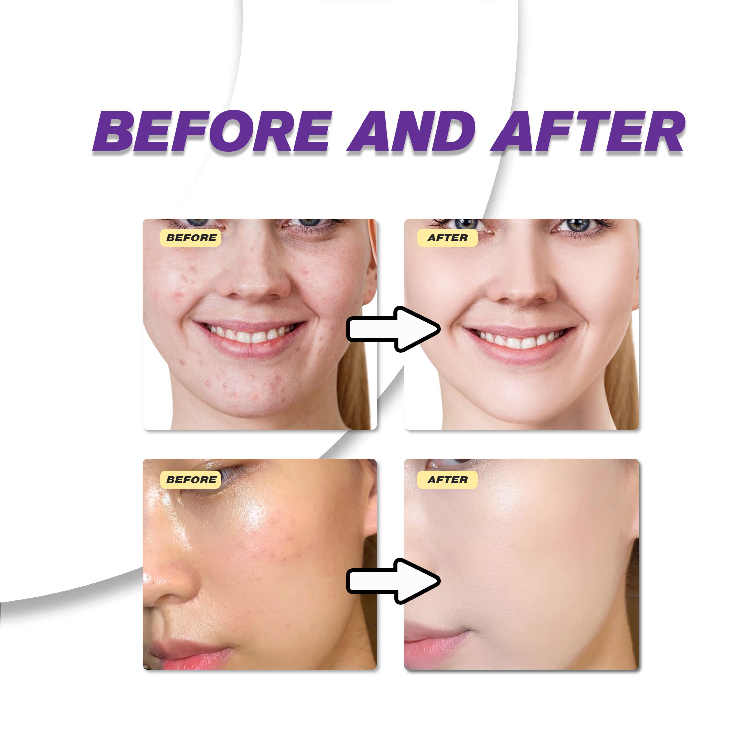 Crema de Ácido Azelaico Suave  - Skincare Skintific reseña y precio
