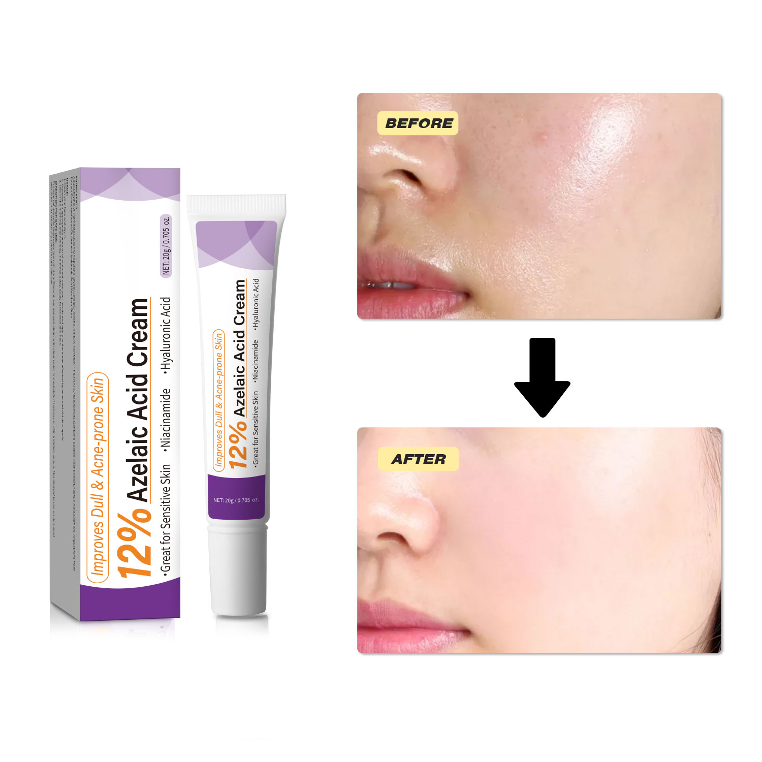 Crema de Ácido Azelaico Suave  - Skincare Skintific reseña y precio